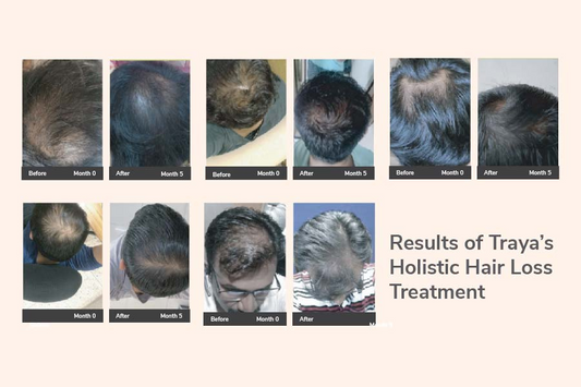 hair loss causes