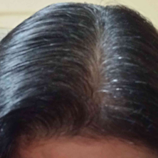 Month 4