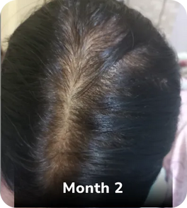 Month 1