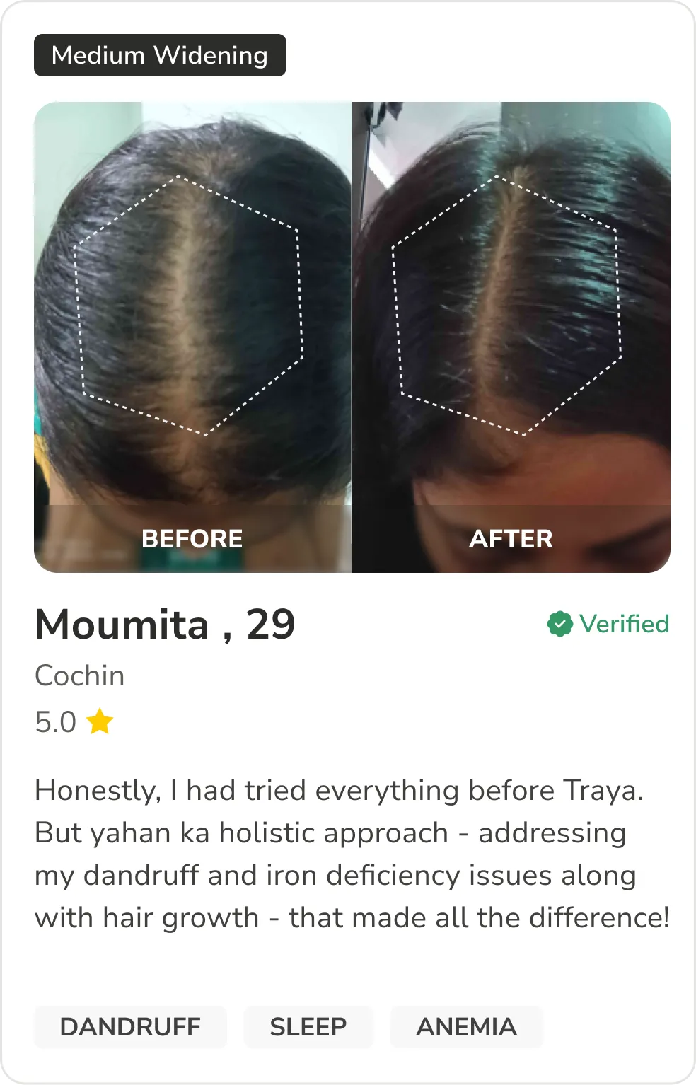 Month 1 Hair Progress