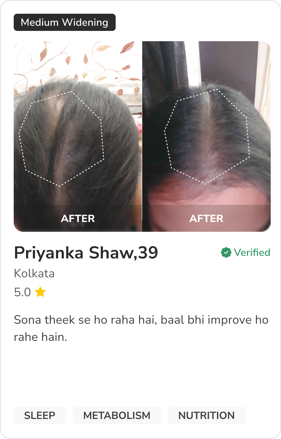 Month 1 Hair Progress