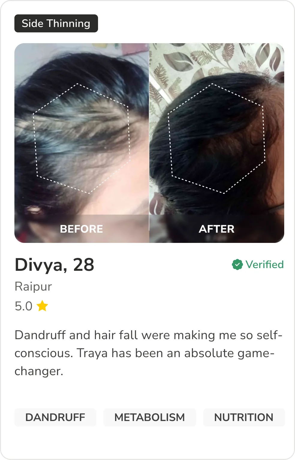 Month 1 Hair Progress