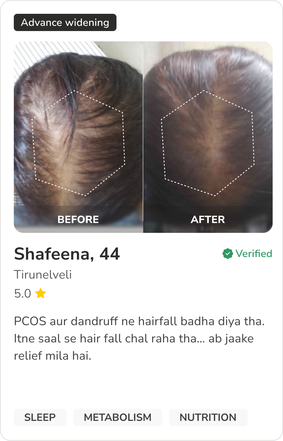 Month 1 Hair Progress