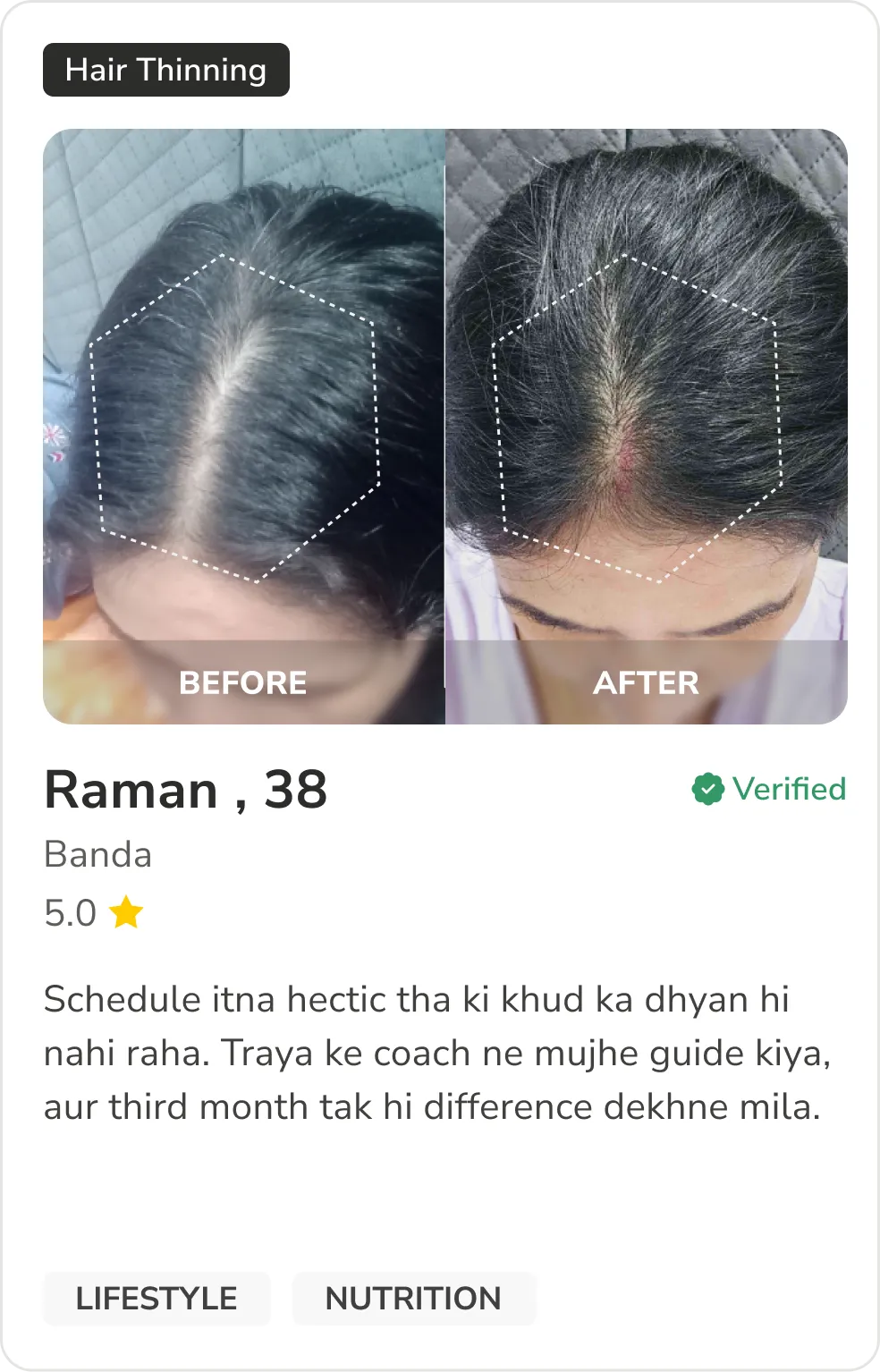 Month 1 Hair Progress