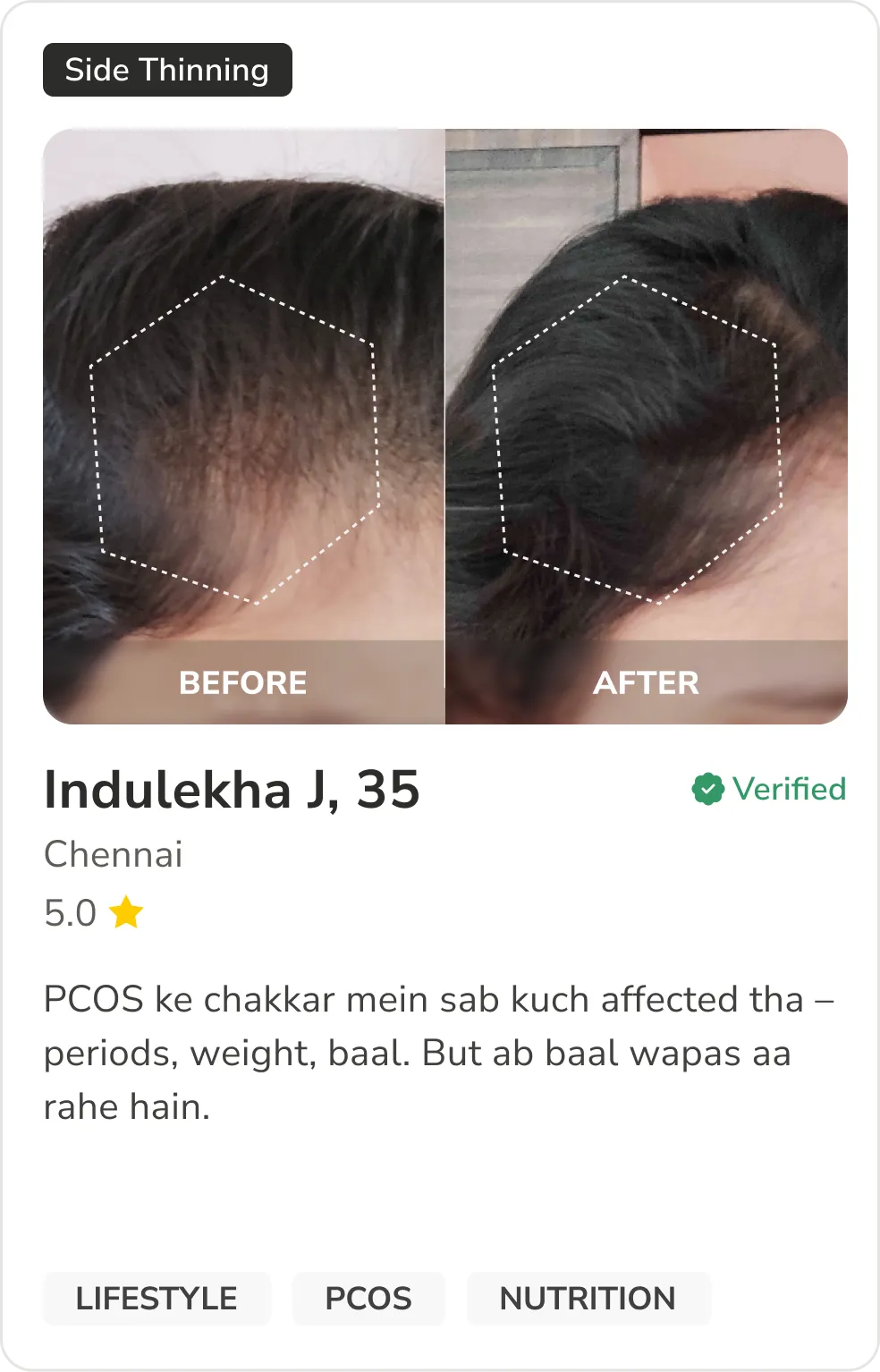 Month 1 Hair Progress