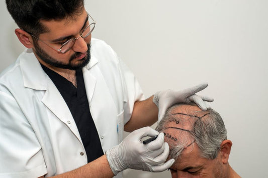 How Much Does A Hair Transplant Cost in India?