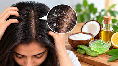 1 दिन में डैंड्रफ कैसे हटाएं? असरदार घरेलू उपाय जानें