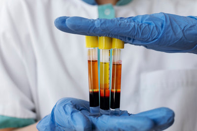 What is PRP Hair Treatment? Your Go-To Guide To PRP
