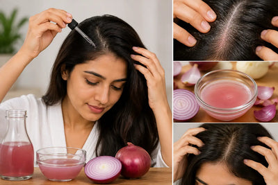 खुजली वाले Scalp के लिए Onion Juice: क्या यह फायदेमंद है?