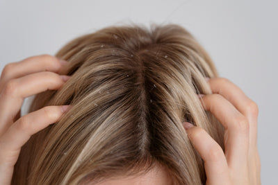 Scalp Psoriasis And Hair Loss: What You Need To Know
