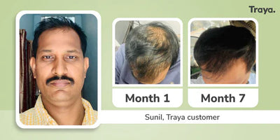 Traya Honest Review: Real Stories, Transparent Feedback & What to Expect