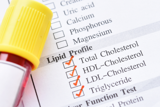 Lipid Profile Test in Hindi | लिपिड प्रोफाइल क्या है, खर्च, नॉर्मल रेंज, कैसे होता है, क्यों और कब