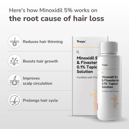 Minoxidil for Hair Regrowth: Real Science, Real Tips, Real Results