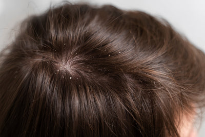 Flaky Scalp After Shampooing: Reasons Explained