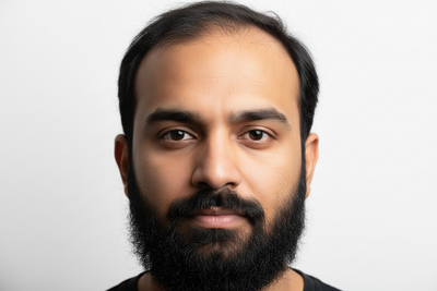 Beard Growth vs Scalp Hair Loss: How Testosterone Affects Both