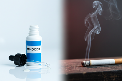 Can Smoking Reduce the Effectiveness of Minoxidil?