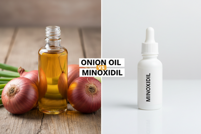 Onion Oil vs Minoxidil for Hair Growth