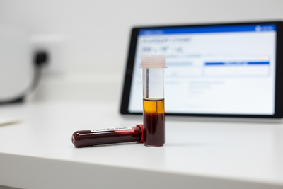 Platelet Count and PRP Eligibility