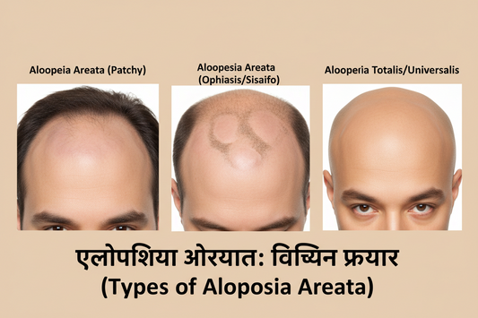 एलोपेशिया एरियाटा के प्रकार: पूरी गाइड