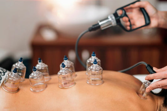 Does Cupping Therapy Help In Hair Growth?