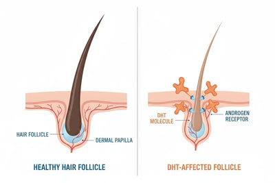 DHT and Hair Follicle Miniaturization: A Microscopic View