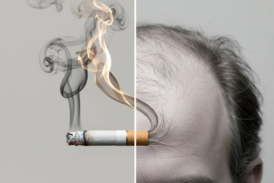 Hair Loss Risk in Long-Term Smokers