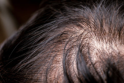 What is Hair Density - How to measure hair density?
