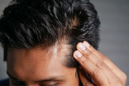 Hair Thinning: How To Fix And Avoid (An Expert Guide)