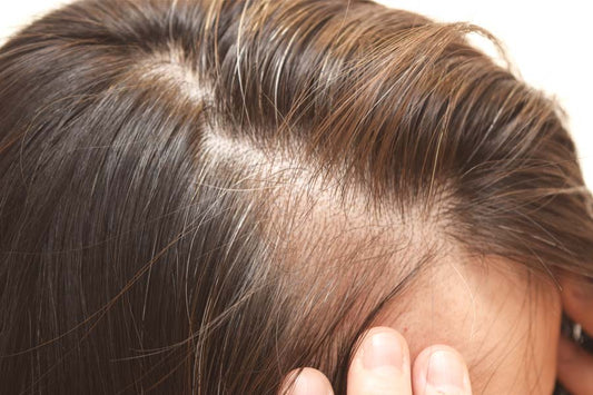 reasons for hair thinning in women, causes, diet and treatment