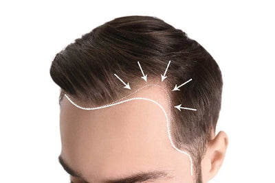 Maturing vs Receding Hairline: Don’t Let Hair Loss Control You
