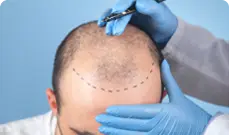 Best Treatment for Hair Thinning in India | Traya Guide