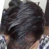 After