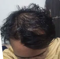 Before
