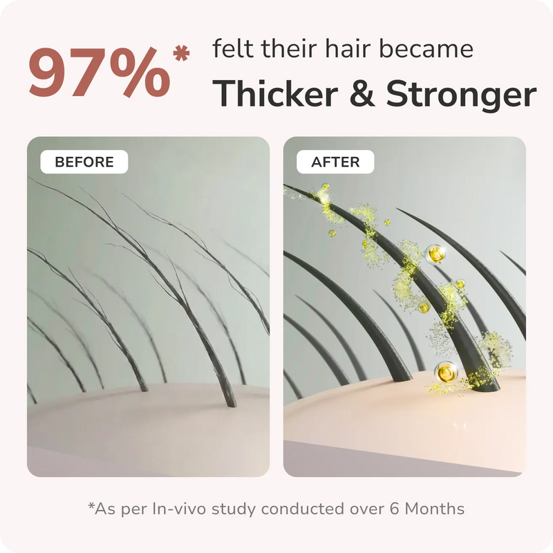 Traya is proven to reduce Hair Fall