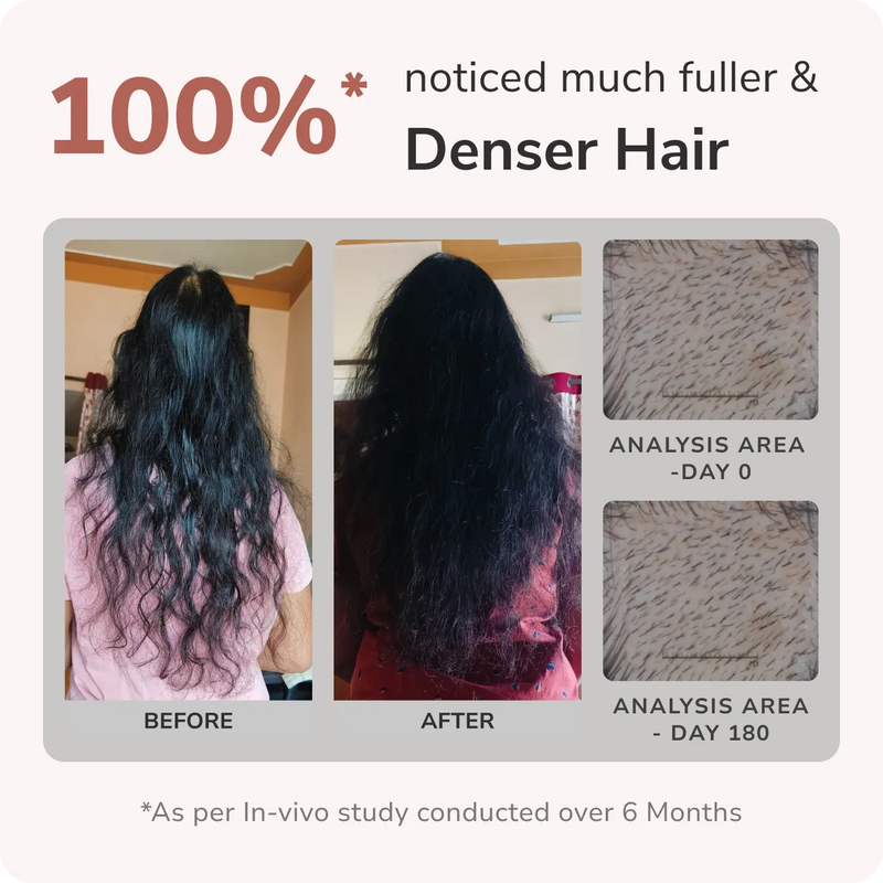 Traya is proven to reduce Hair Fall