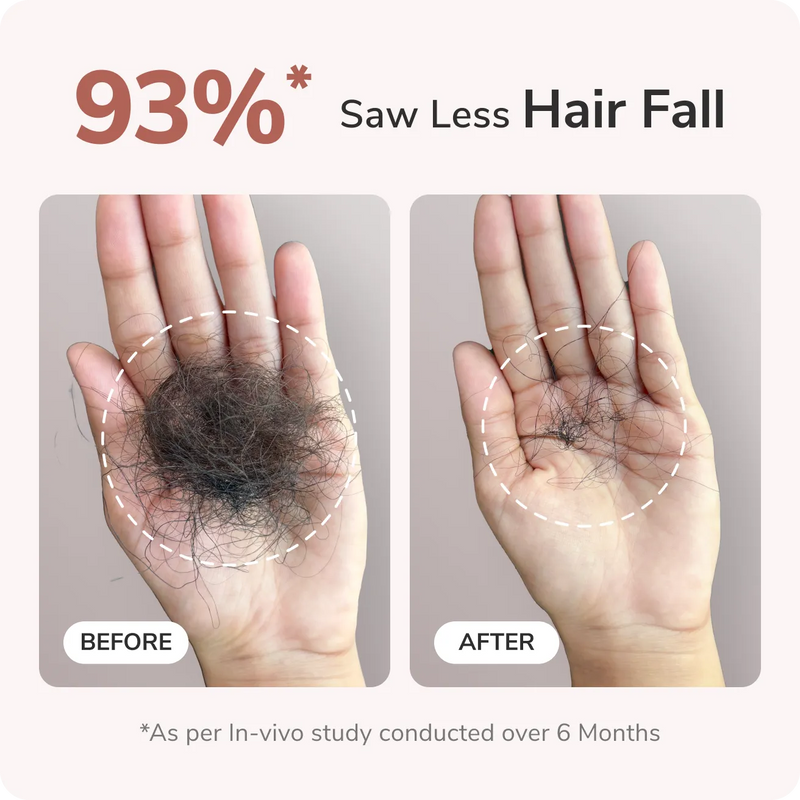 Traya is proven to reduce Hair Fall
