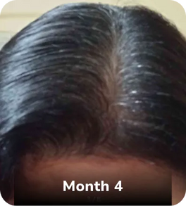 Month 2