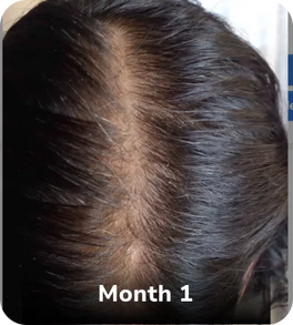 Month 1