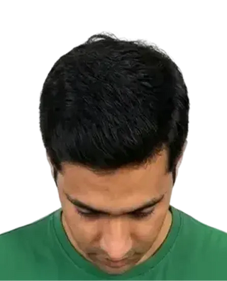 Stage 1