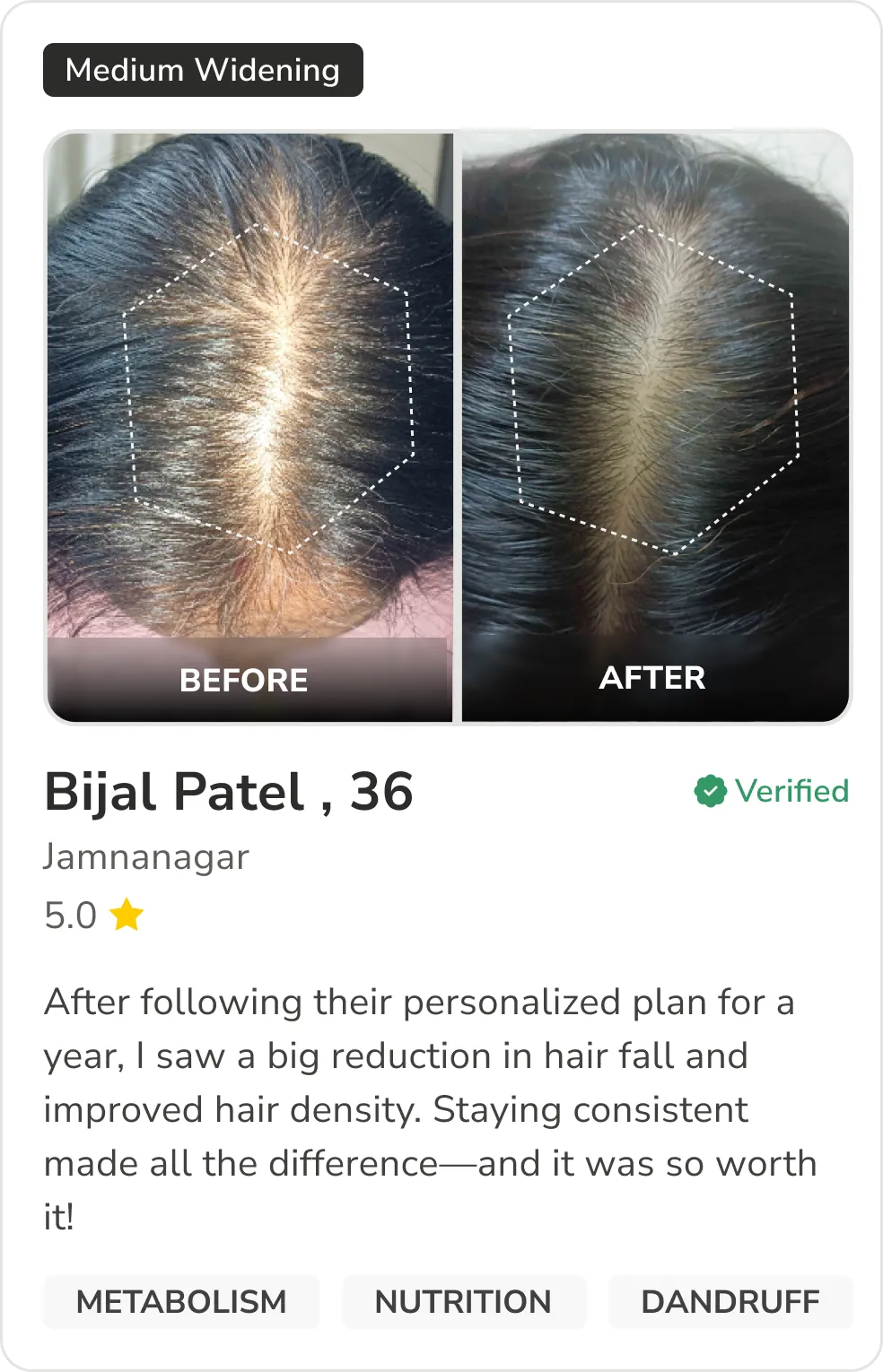 Month 1 Hair Progress
