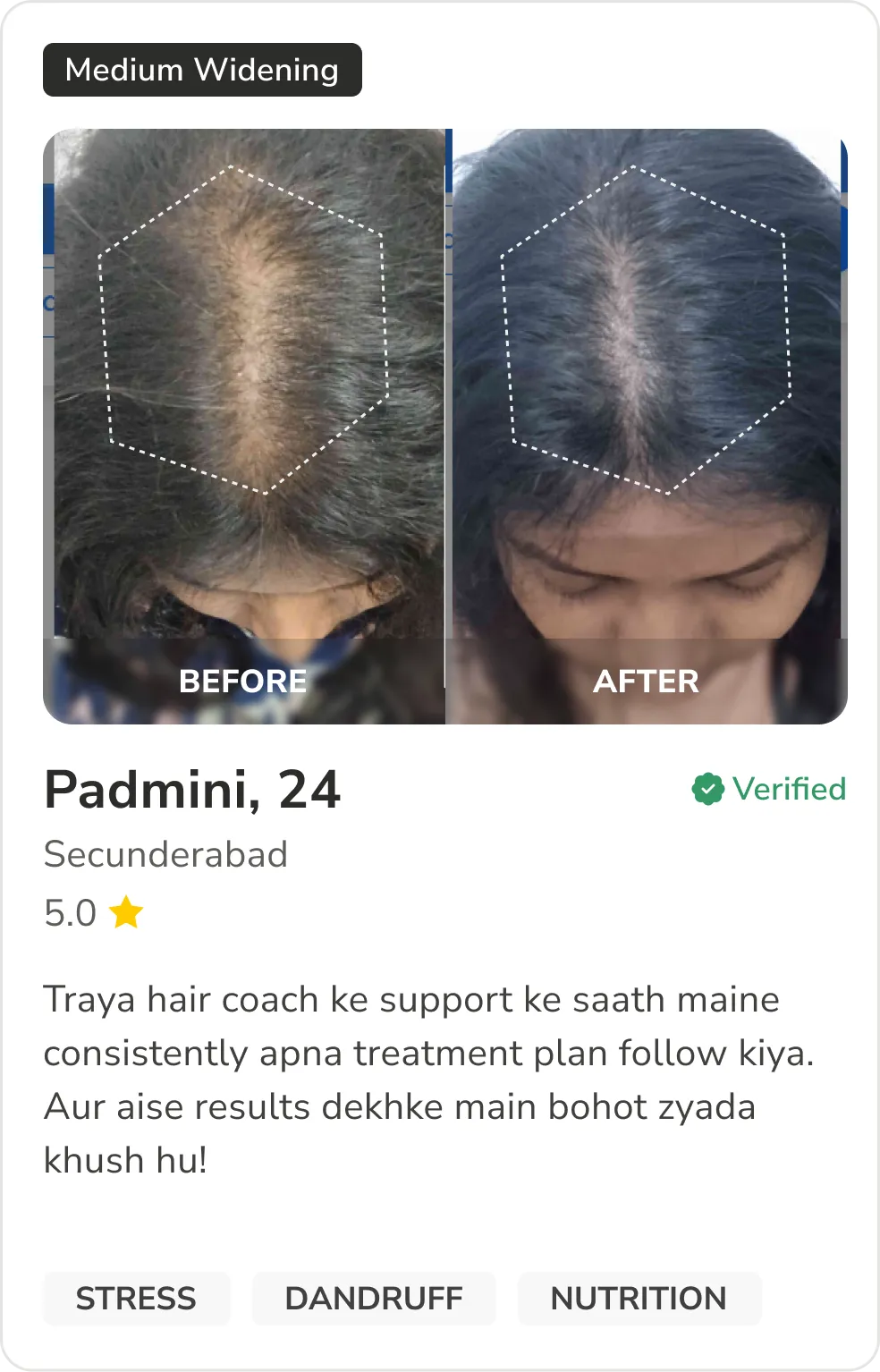 Month 1 Hair Progress