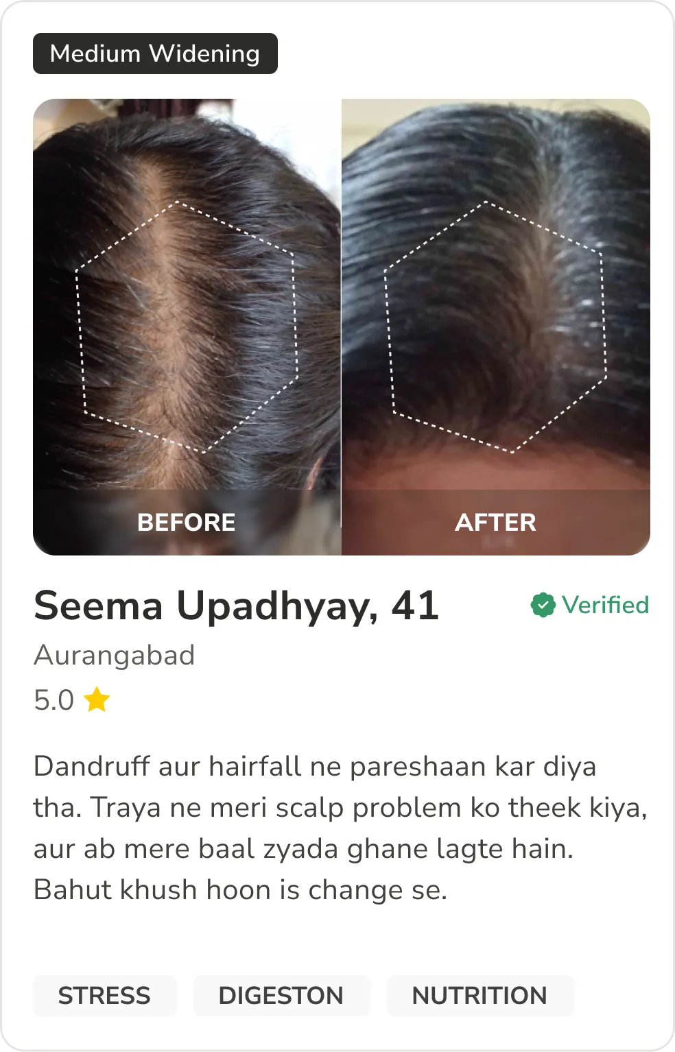 Month 1 Hair Progress