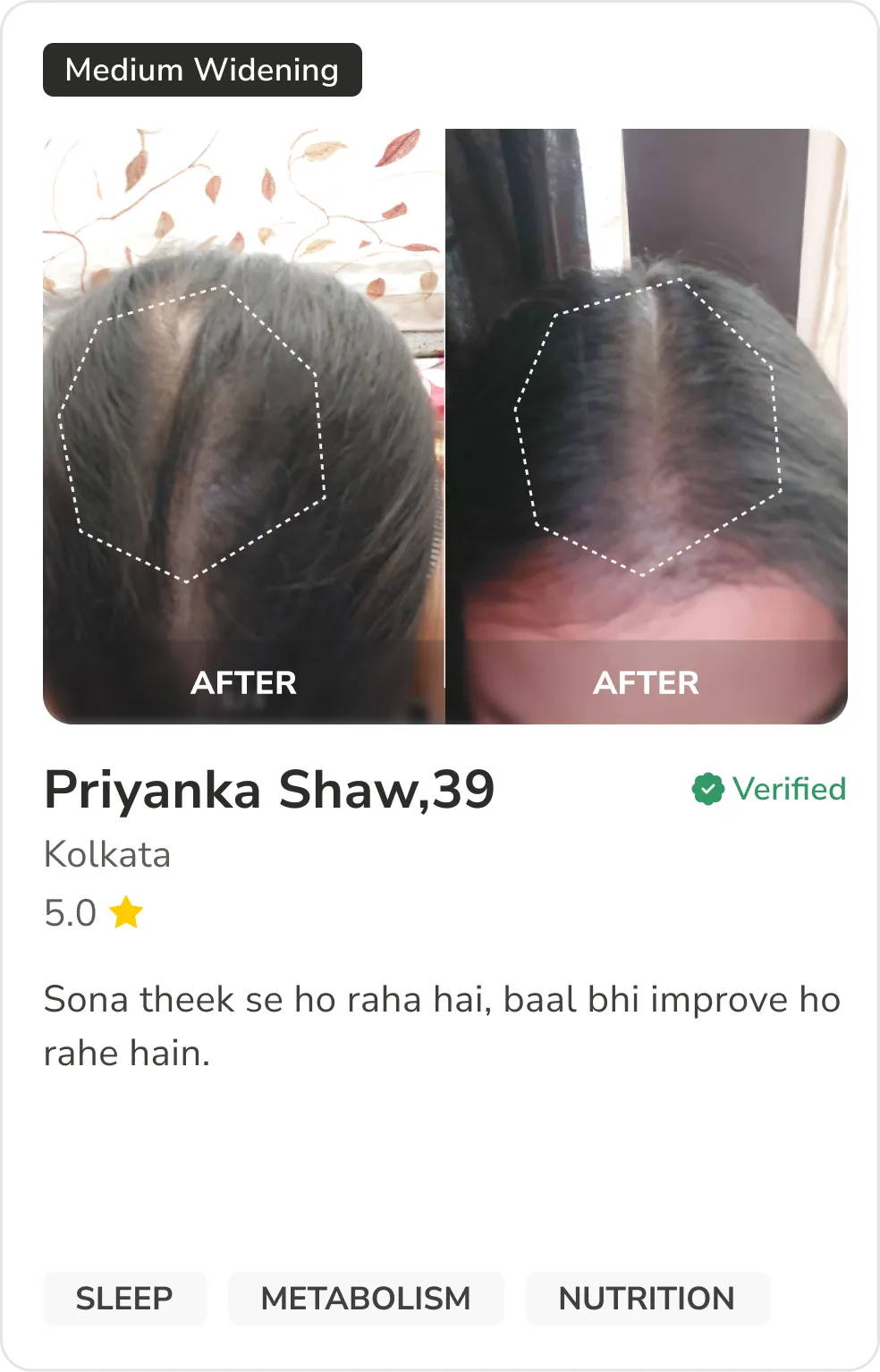 Month 1 Hair Progress