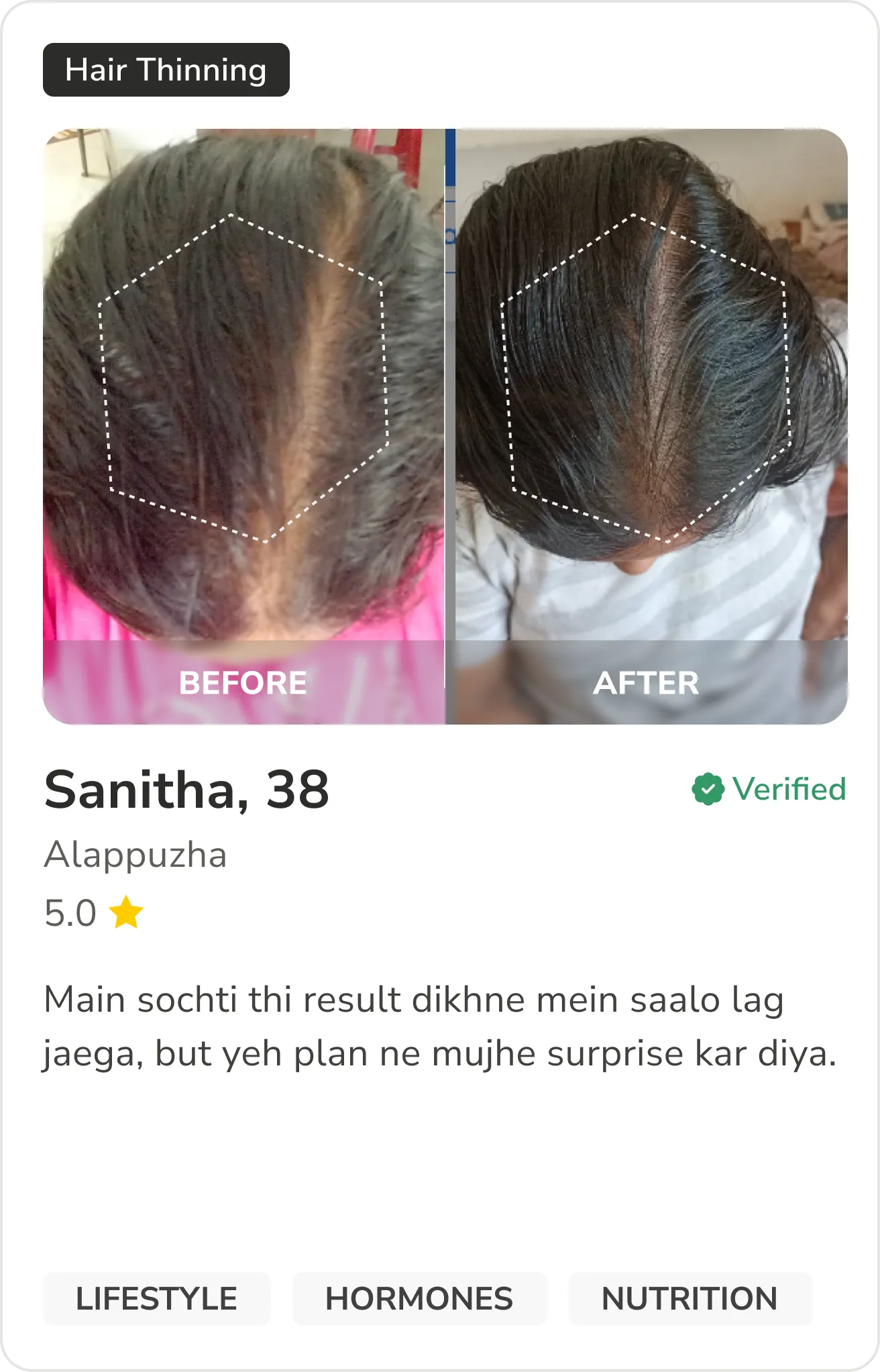 Month 1 Hair Progress