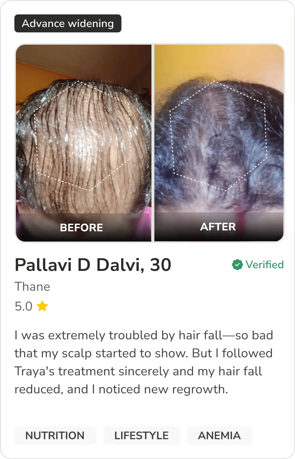 Month 1 Hair Progress