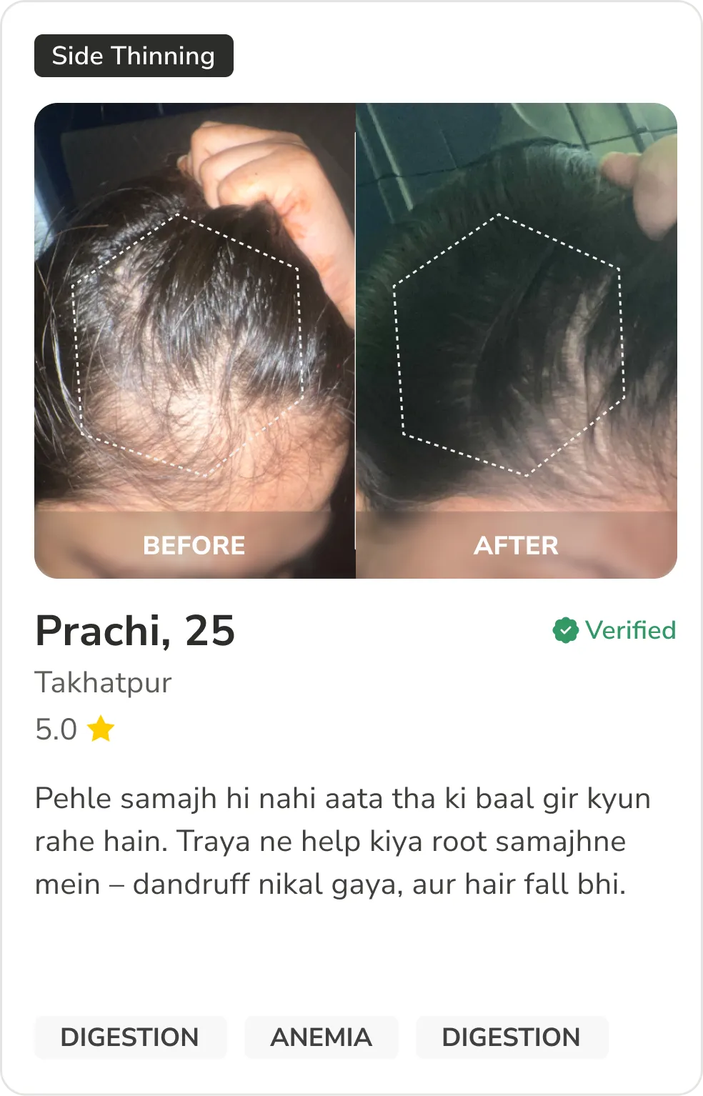 Month 1 Hair Progress