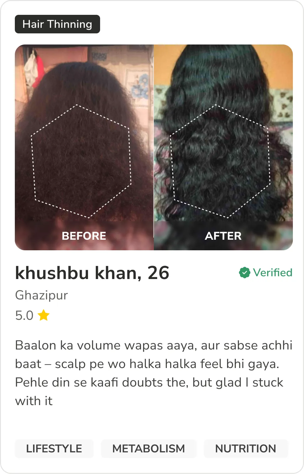 Month 1 Hair Progress