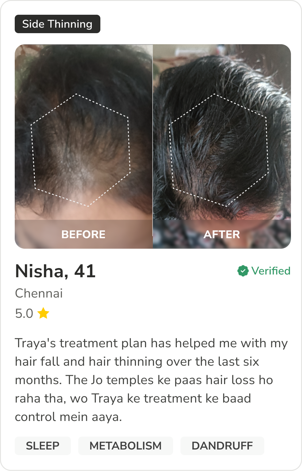 Month 1 Hair Progress