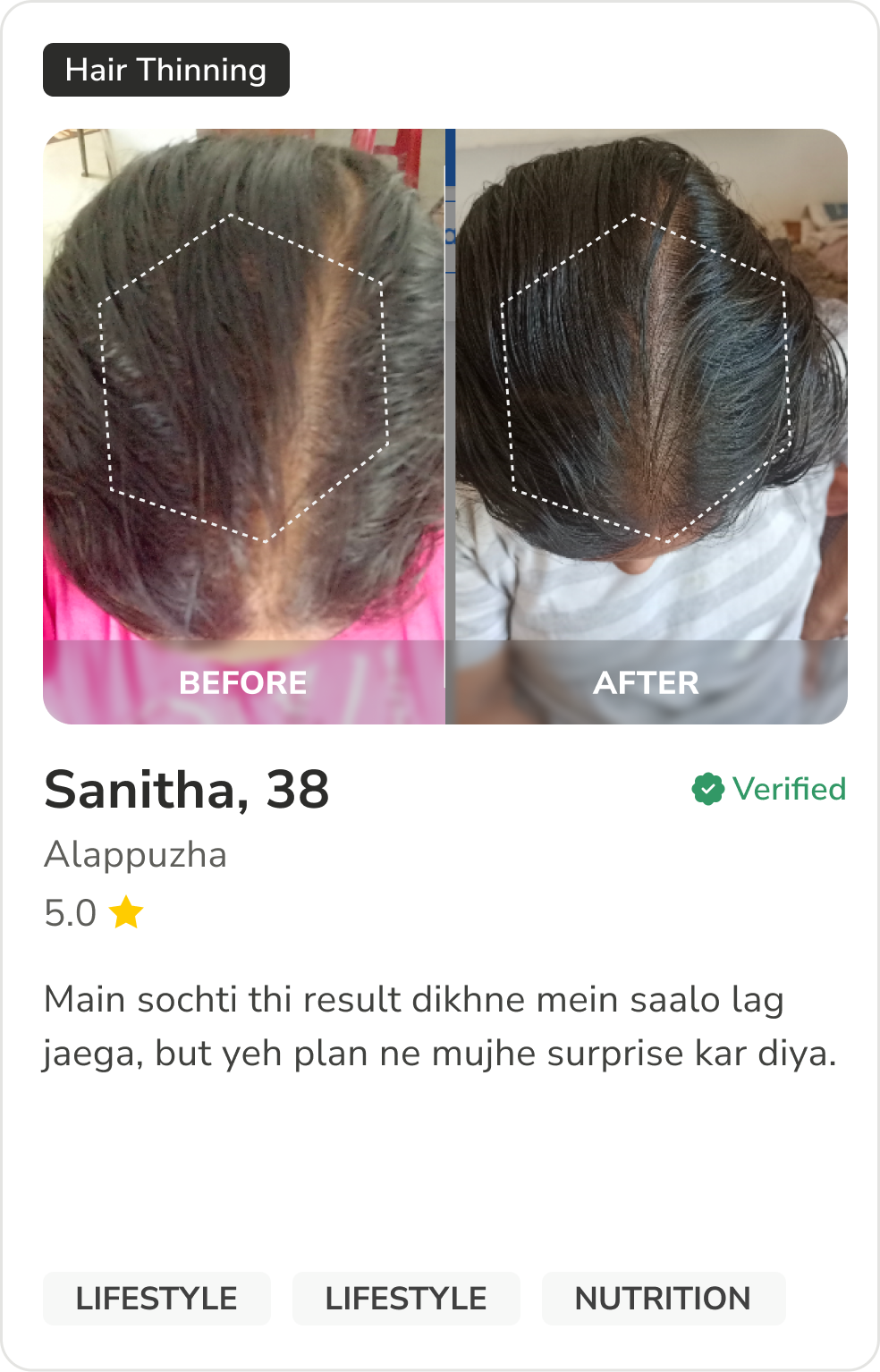 Month 1 Hair Progress