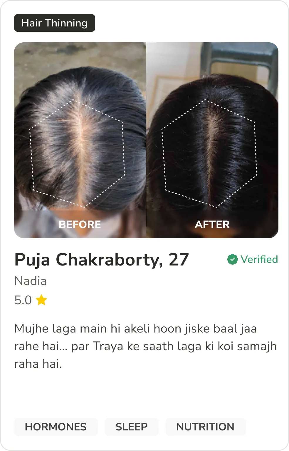Month 1 Hair Progress